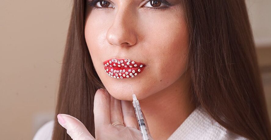 การเสริมริมฝีปากให้สวยงามและการแก้ไขโดยใช้ฟิลเลอร์